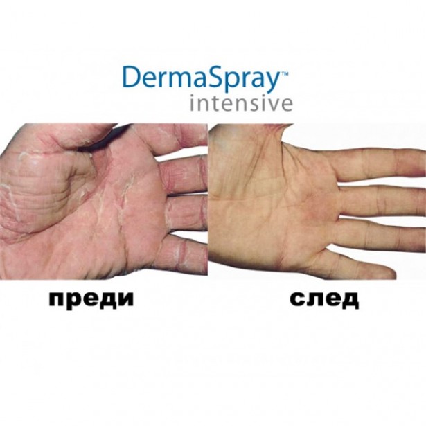 Dermaspray Intensive ( ДермаСпрей Интензив ) - Решението на всички кожни проблеми.